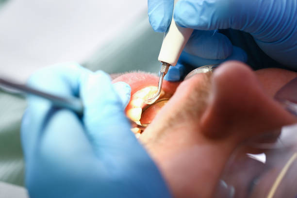 Best Emergency Broken Tooth Repair in Springfield, SD