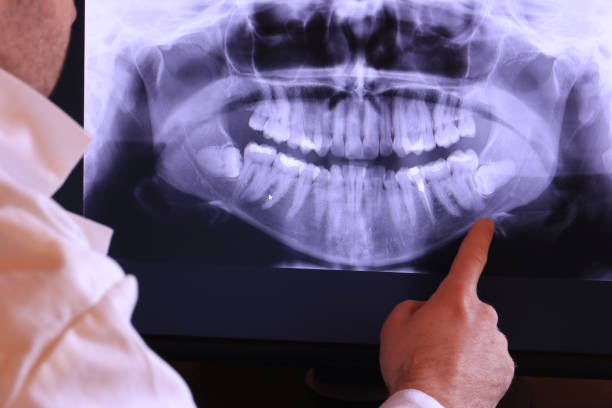 Best Emergency Broken Tooth Repair in Springfield, SD