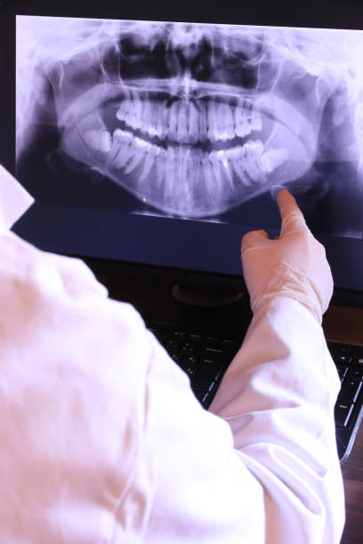 Best Walk-In Emergency Dentist in Springfield, SD