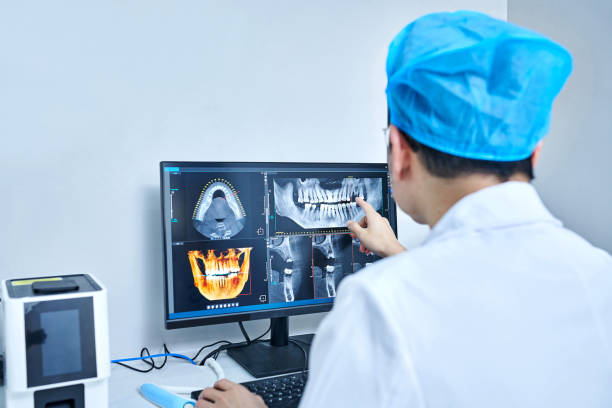 Best Emergency Tooth Extraction in Springfield, SD